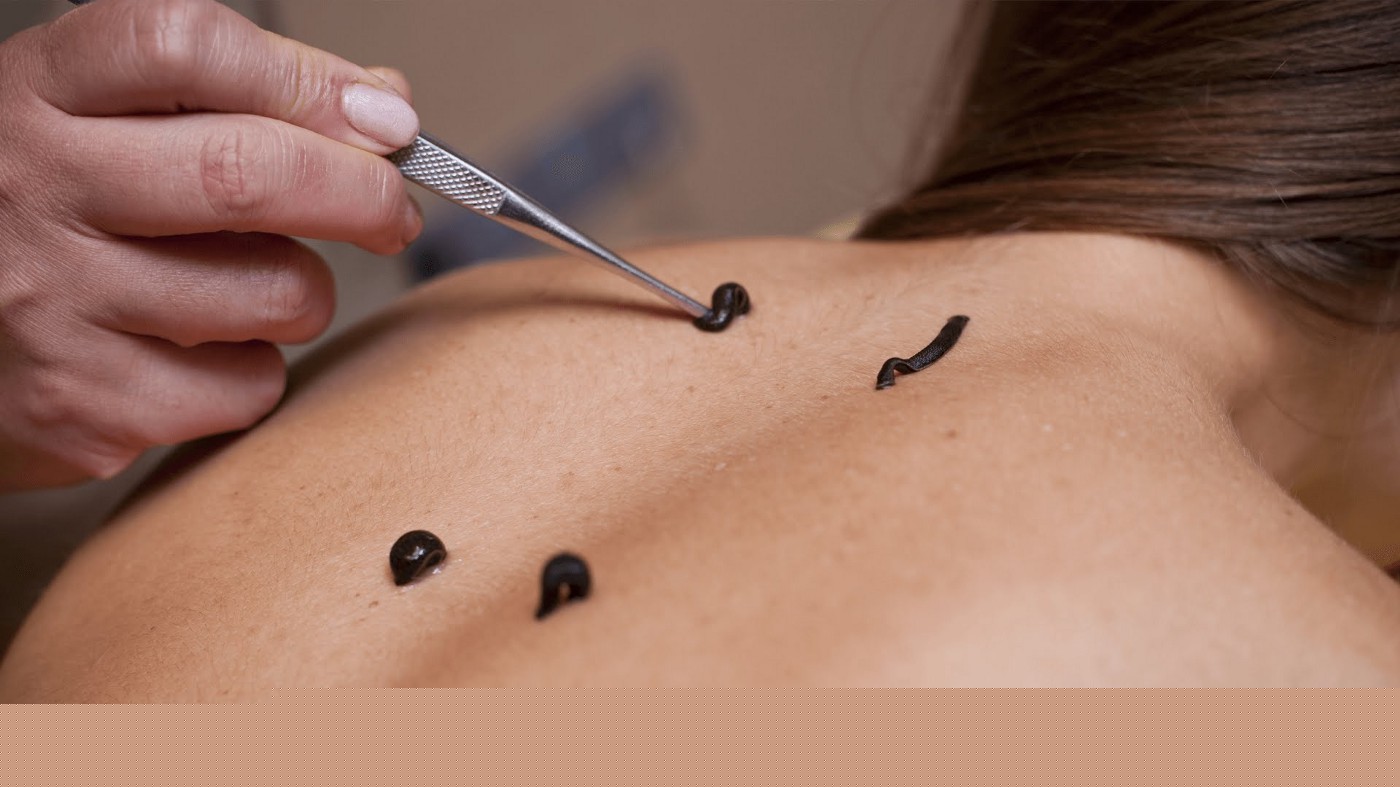 SHAFI AYURVEDA MARMACHIKILSALAYAM